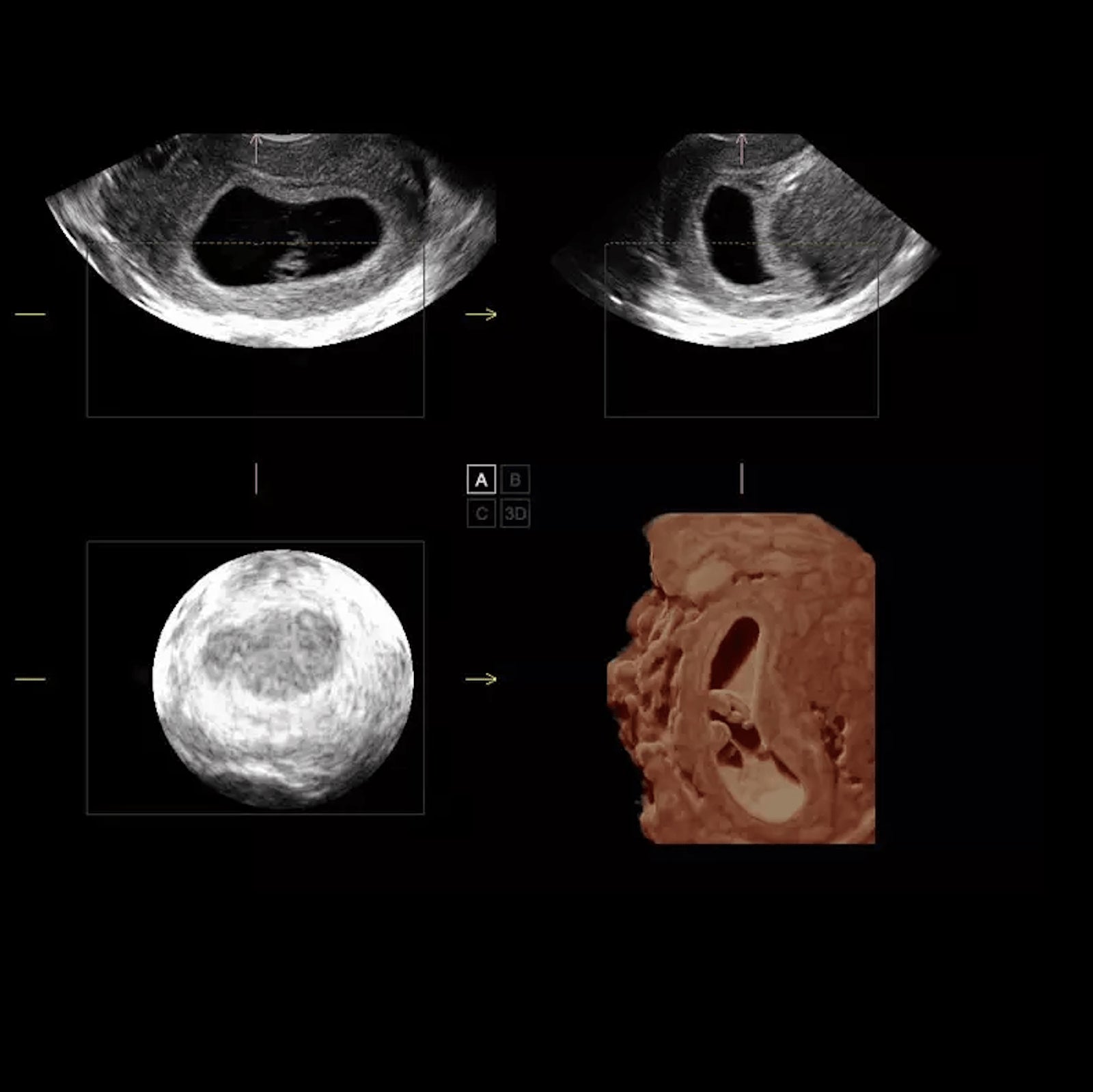 S50 Wireless Wi-Fi Connection Ultrasound Machine Sonoscape S50 S-Live Trolly Color Doppler with Single Crystal Probes - Pet medical equipment