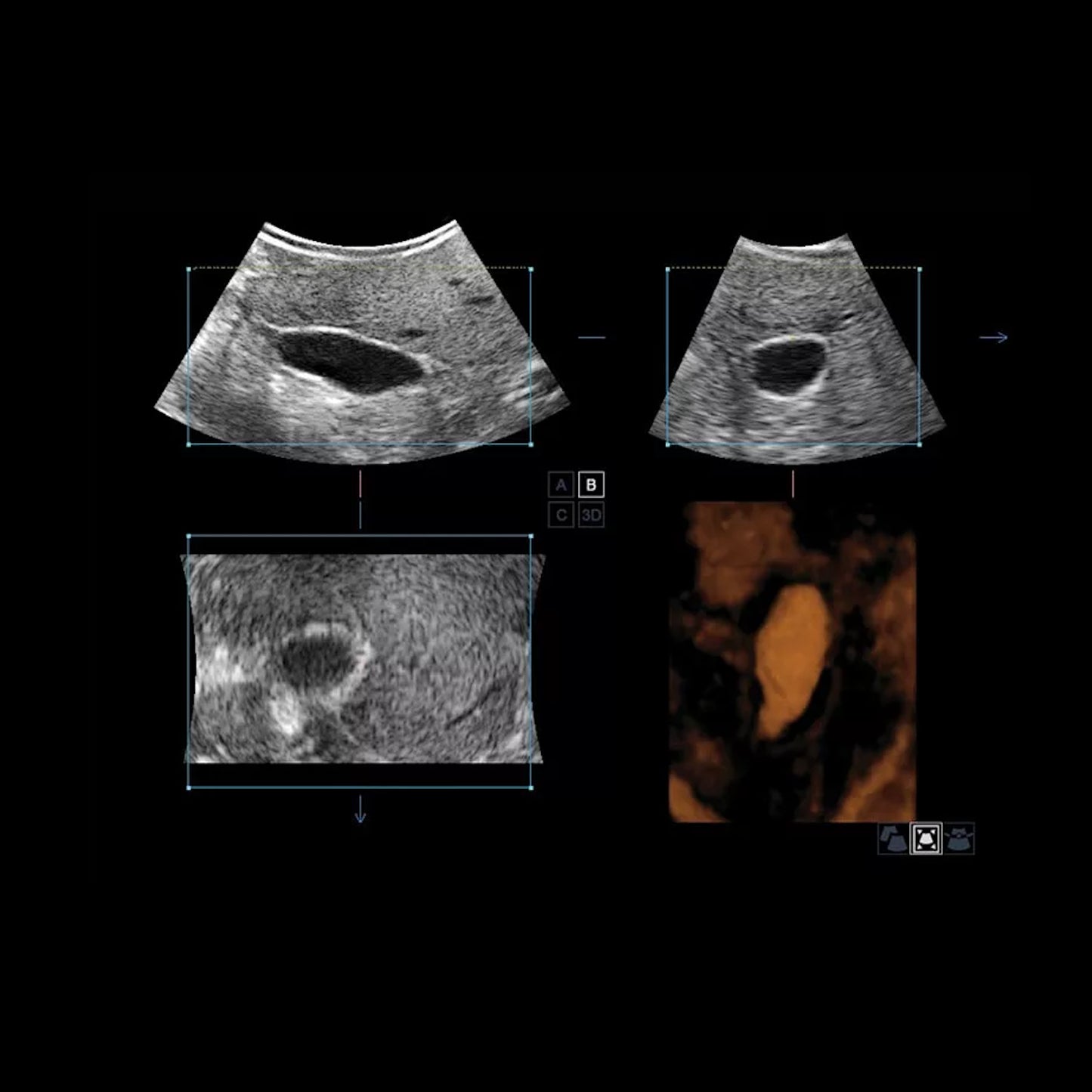 S50 Wireless Wi-Fi Connection Ultrasound Machine Sonoscape S50 S-Live Trolly Color Doppler with Single Crystal Probes - Pet medical equipment