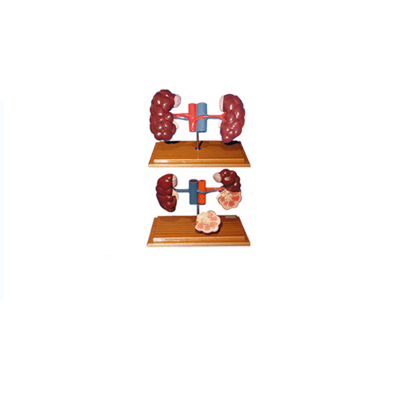 The Dissection Model of Cattle kidneyl(2parts) - Pet medical equipment