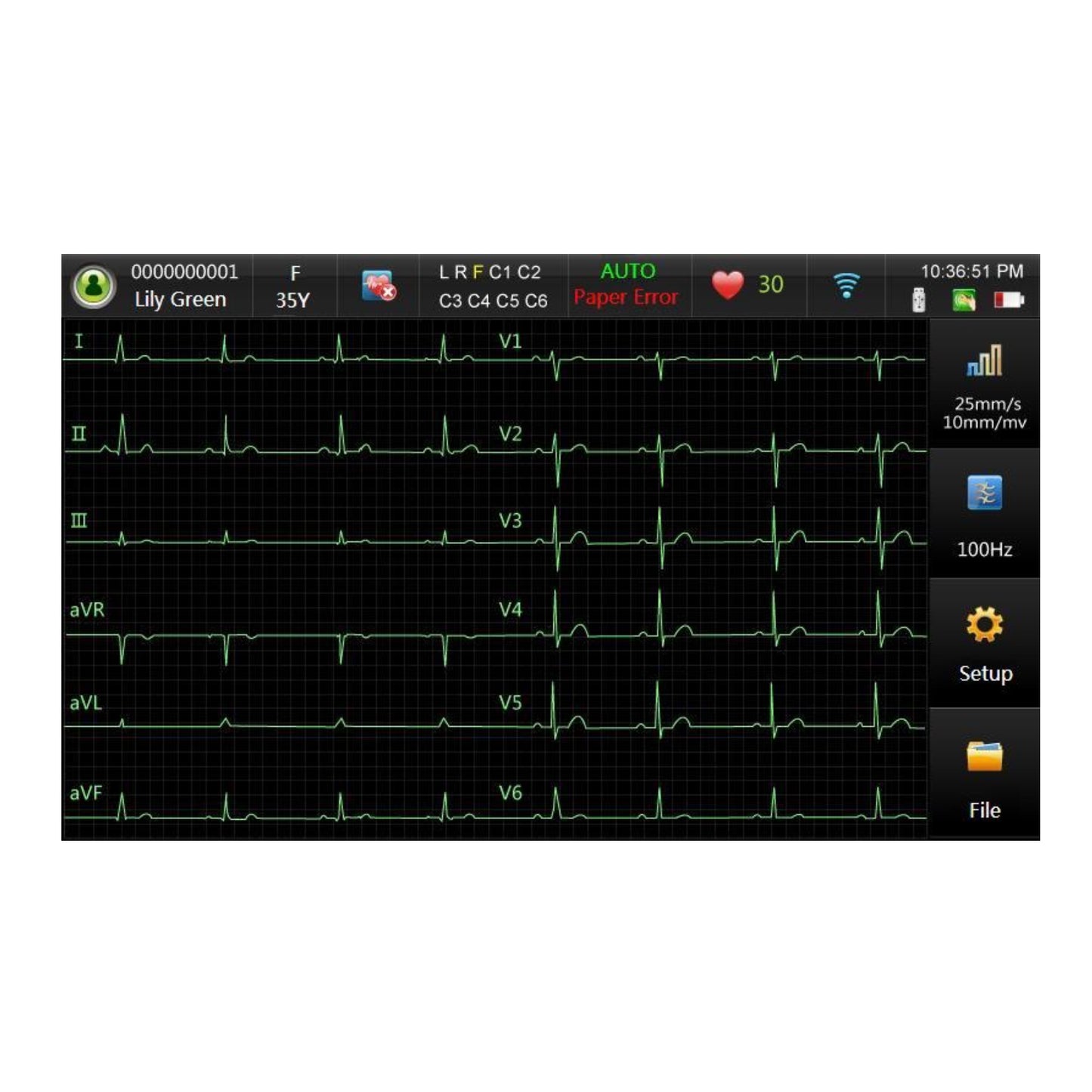 Touch Screen EDAN ECG SE-301 SE-301 B Electrocardiograph 3 Channel ECG - Pet medical equipment